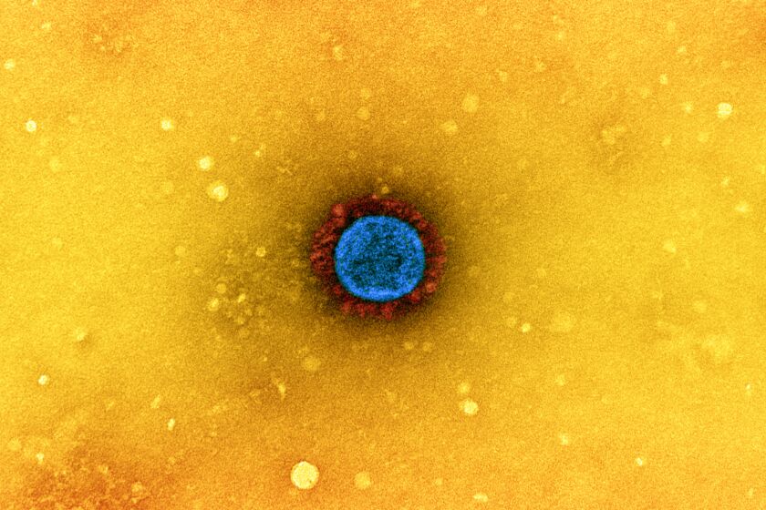A SARS-CoV-2 coronavirus particle isolated from a patient sample and cultivated in cell culture.
