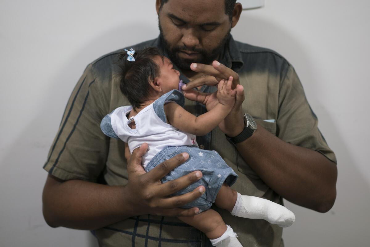 Laurinaldo Alves sostiene a su hija Luana Vitoria, que padece microcefalia, en un centro de tratamiento en Recife, Brasil, 4 de febrero de 2016. (AP Foto/Felipe Dana)