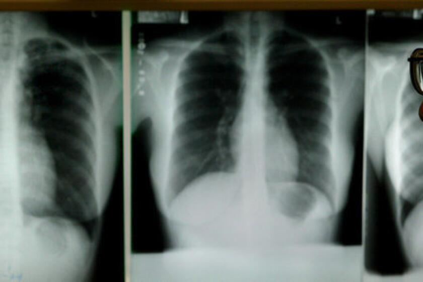 For the first time, tuberculosis rates are on the decline worldwide, the World Health Organization reports.