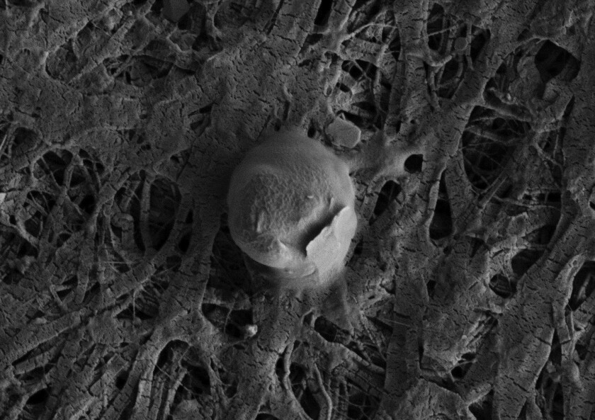 Scientists present definitive proof that life exists .5 miles beneath the ice sheet in the Antarctic lake. Pictured here, a coccoid shaped microbial cell with an attached sediment particle from the Subglacial Lake Whillans water column.