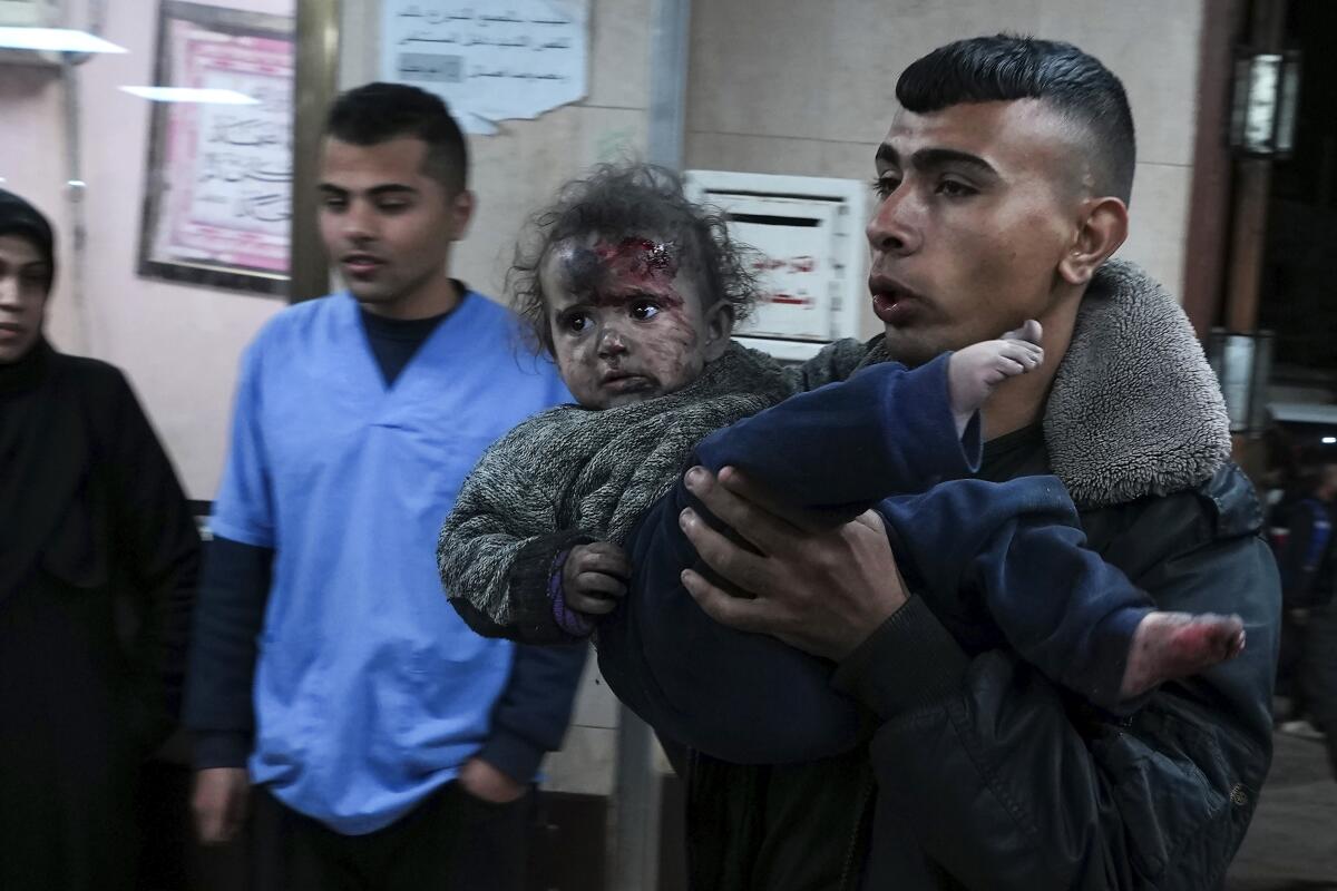 Palestinians wounded in the Israeli bombardment of the Gaza Strip are brought to hospital.