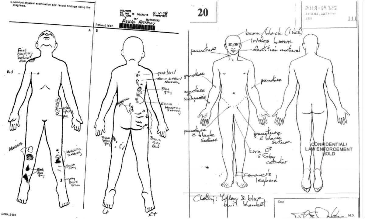 Anthony Avalos Death And The Missed Opportunities To Save Him Los Angeles Times Anthony Avalos Death And The Missed Opportunities To Save Him Los Angeles Times