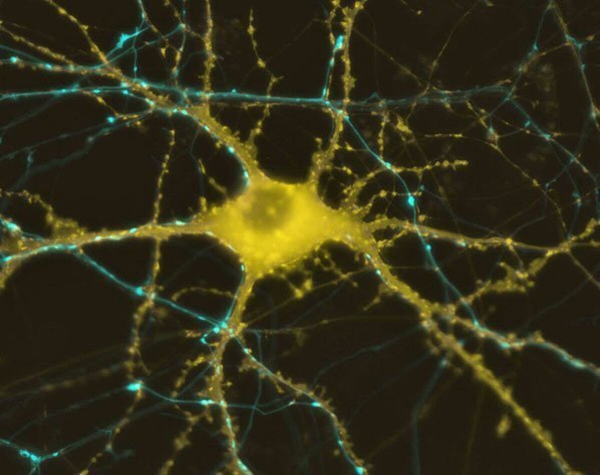 A human neuron.