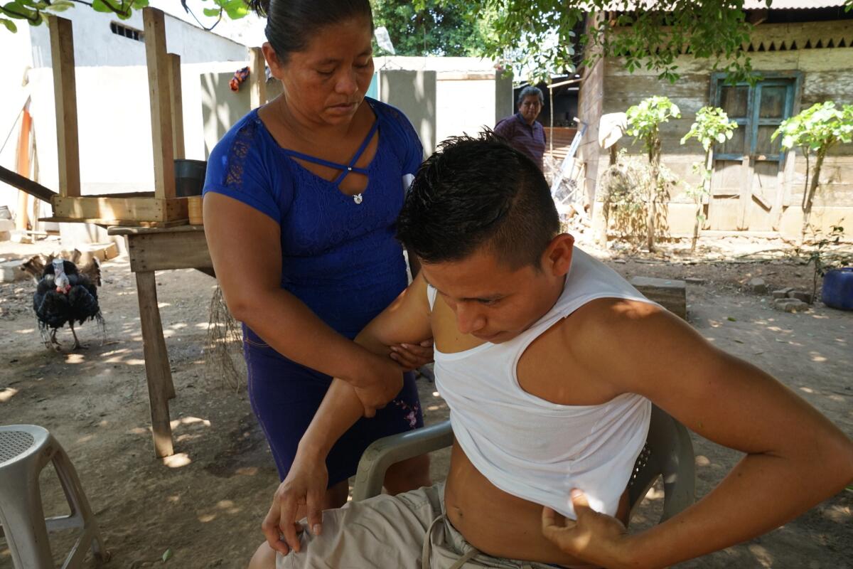 In Nica, Guatemala, Hermelinda Chavez Hernandez treats the injuries her son Carlos Hernandez, 24, suffered in the truck accident a week earlier in Mexico.