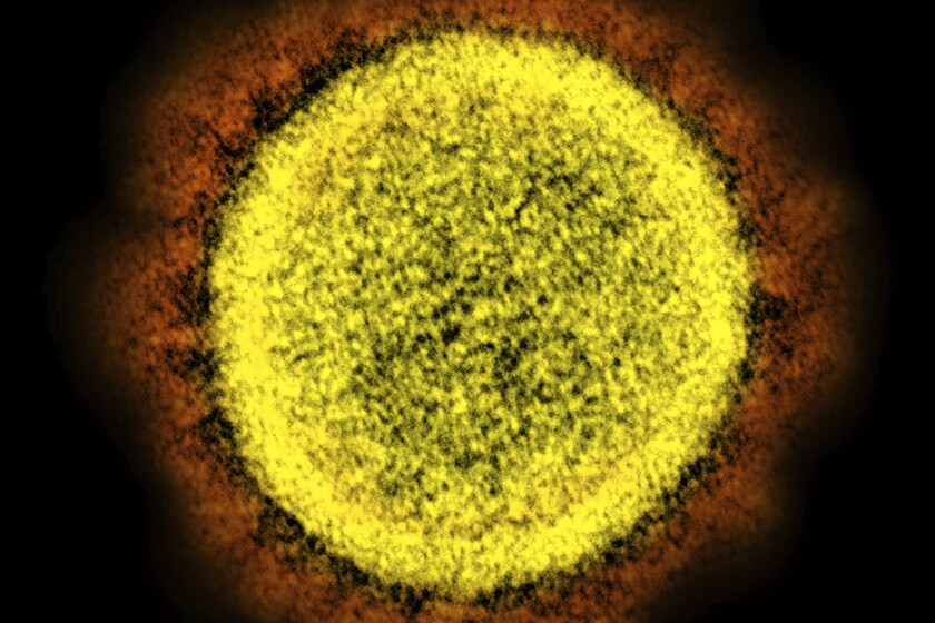 An electron microscope image of a SARS-CoV-2 particle