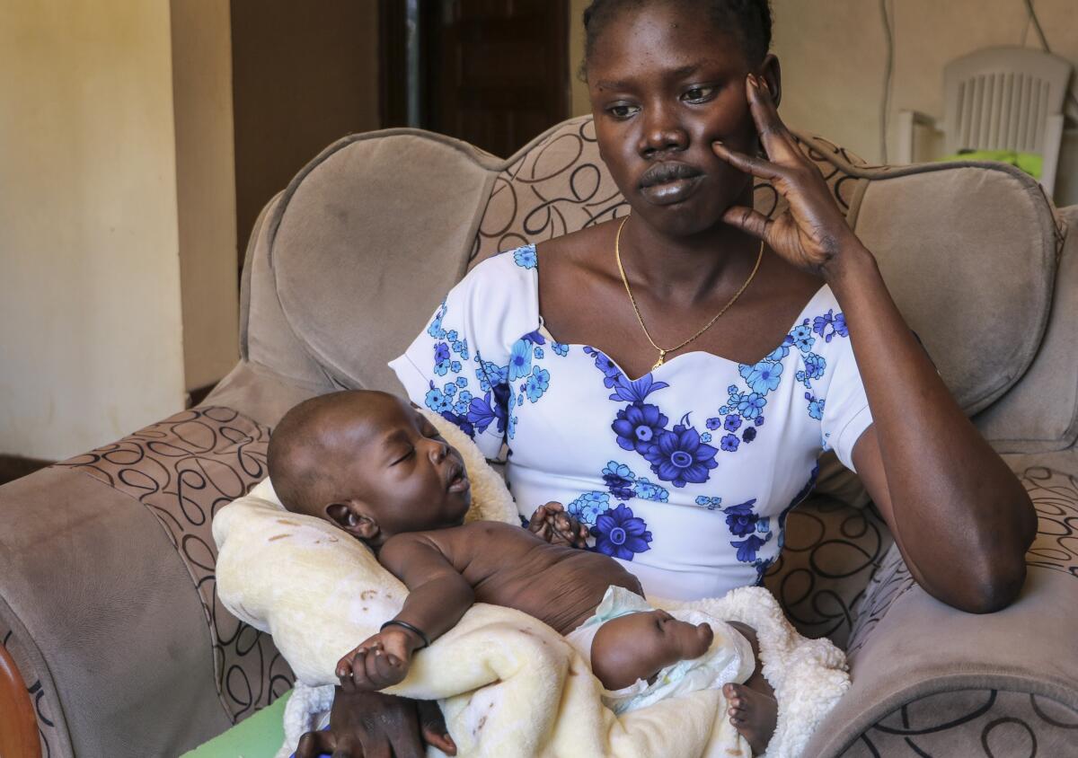 Abui Mou Kueth’s infant son, Ping, was born with six fingers on each hand, one stunted leg, a deformed foot and kidney swelling. “I was shocked the first time I saw the baby,” she said.