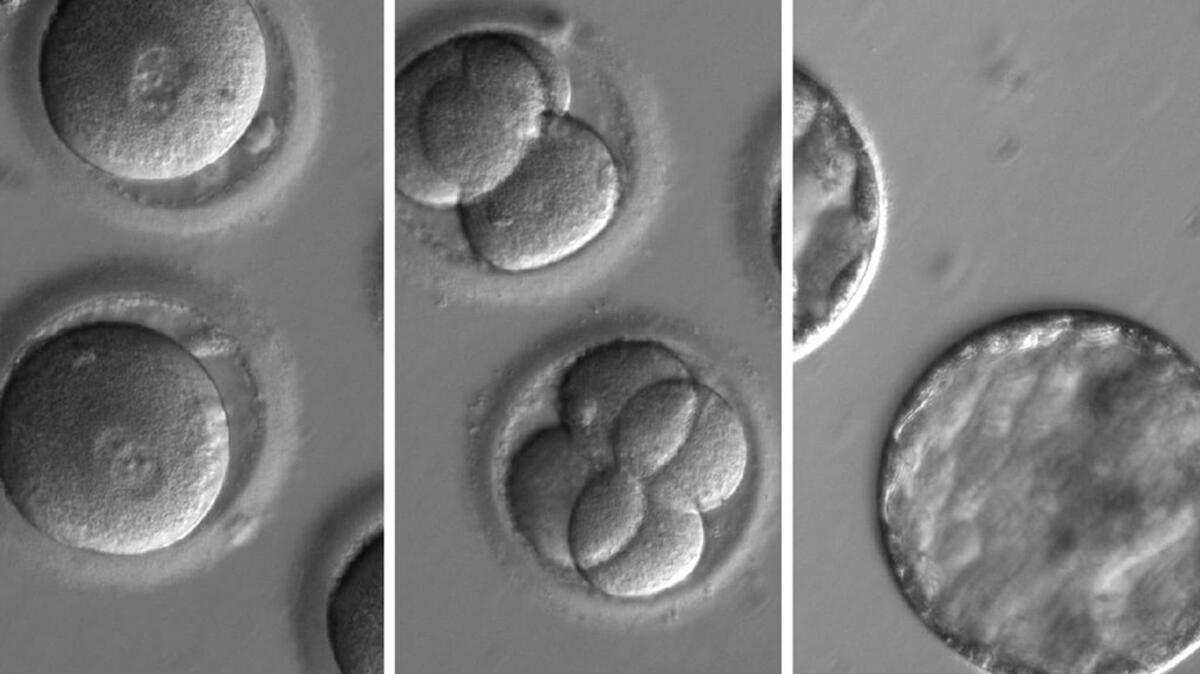 A composite photo made available Thursday shows the development of embryos after the injection of a gene-correcting enzyme and sperm from a donor with a genetic mutation. (Oregon Health & Science University / EPA)