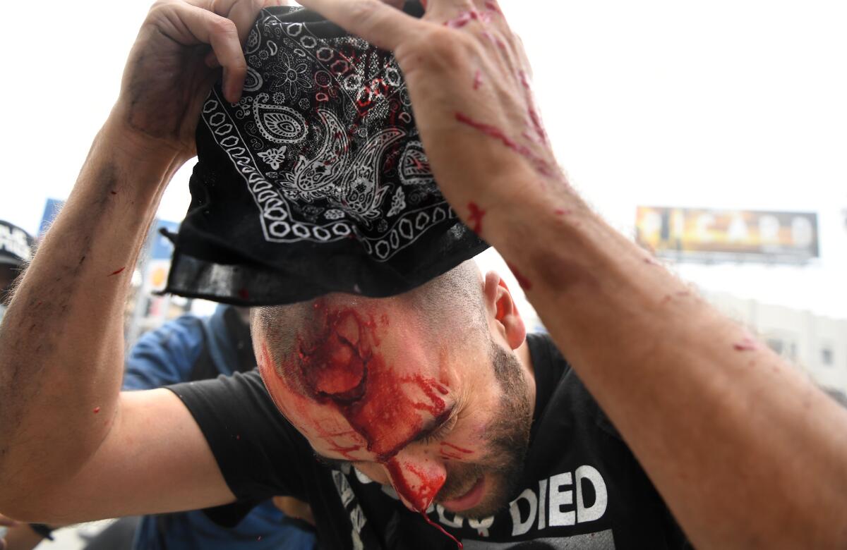 A protester holds a bandanna above a bloody gash on his forehead after being shot with a foam round by police