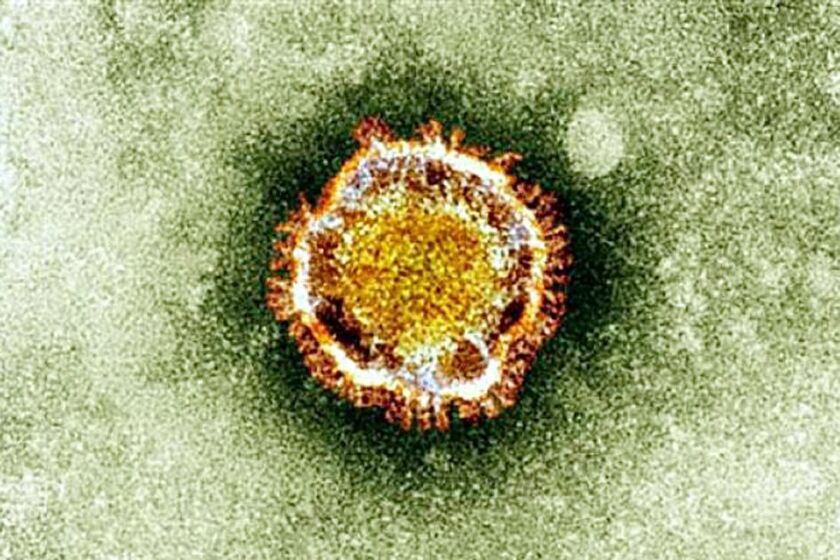 An undated photo from the British Health Protection Agency shows the coronavirus that causes MERS as seen under an electron microscope. A new report details how the virus spread in hospitals in Saudi Arabia.