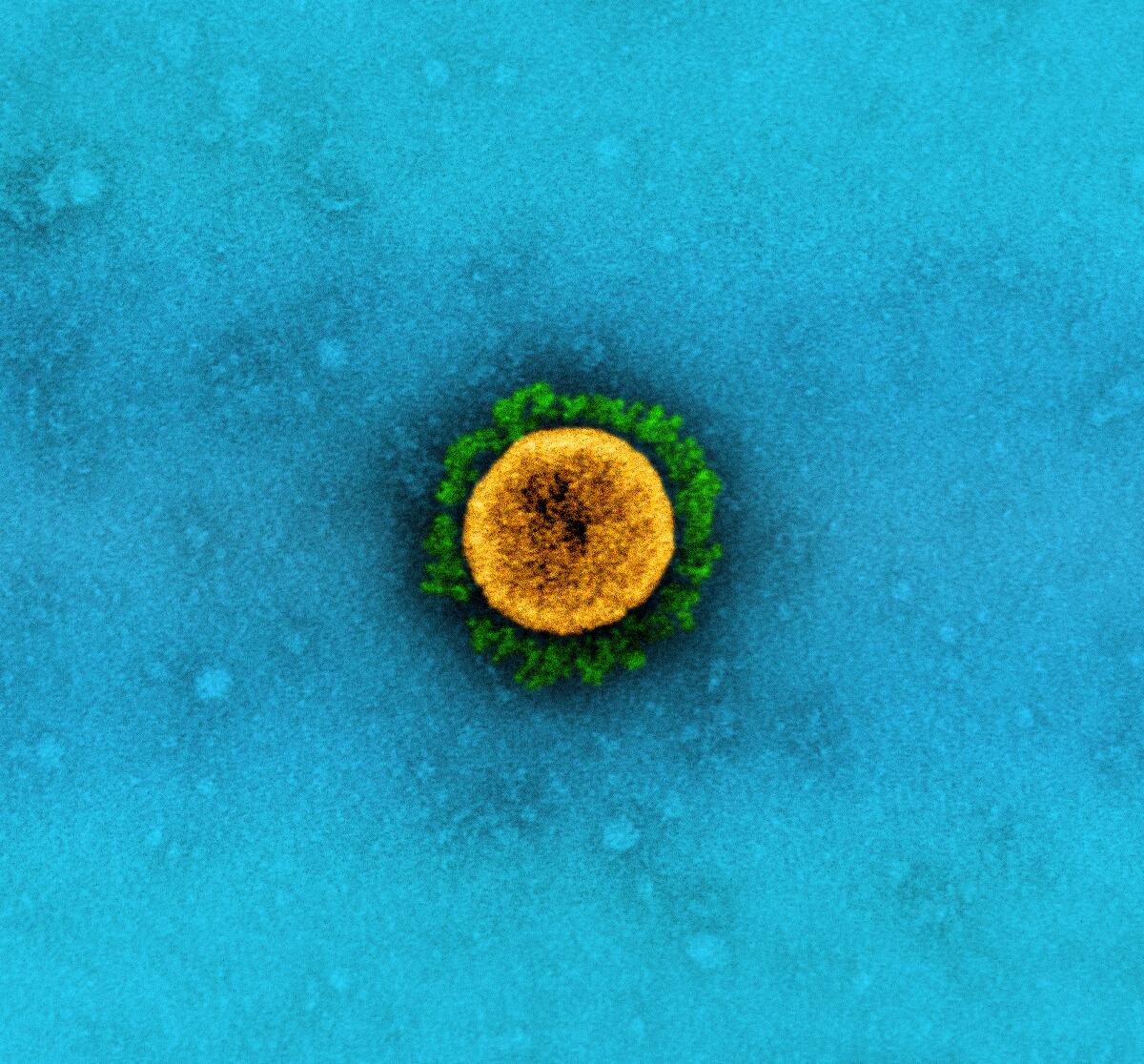 A SARS-CoV-2 virus particle