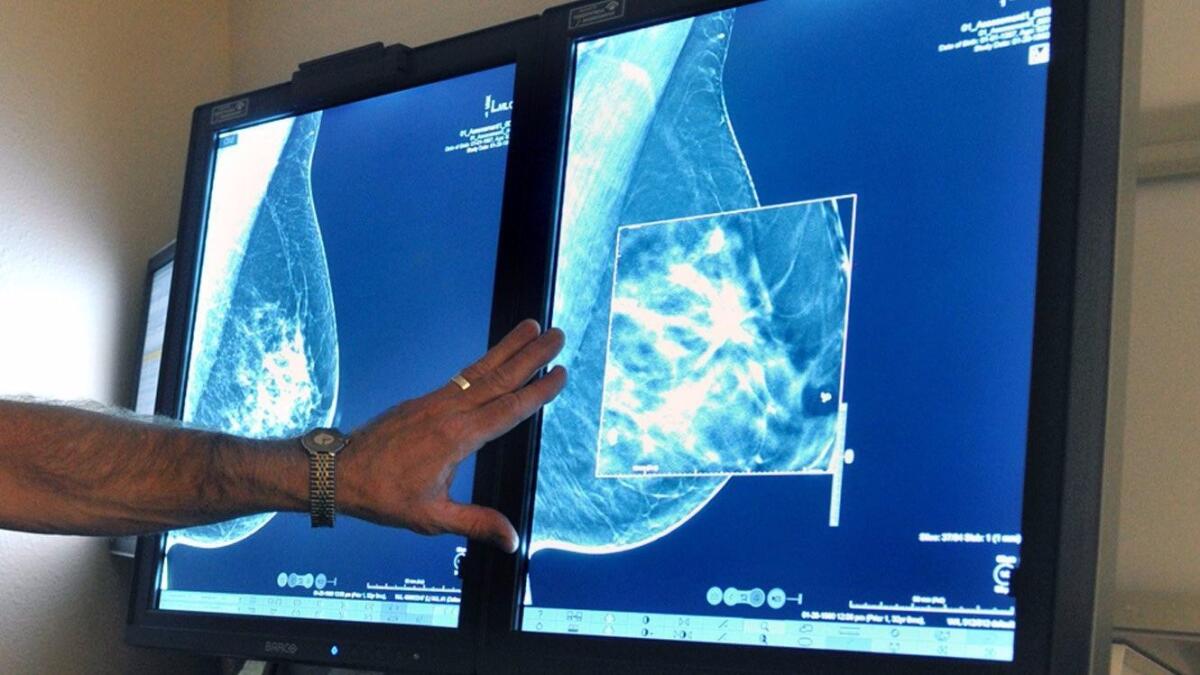 A radiologist compares an image from earlier, 2-D technology mammogram to the new 3-D Digital Breast Tomosynthesis mammography in 2012.