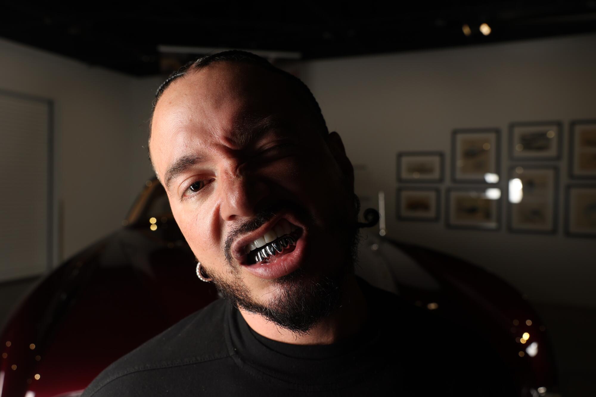 J Balvin flashes his silver grill.