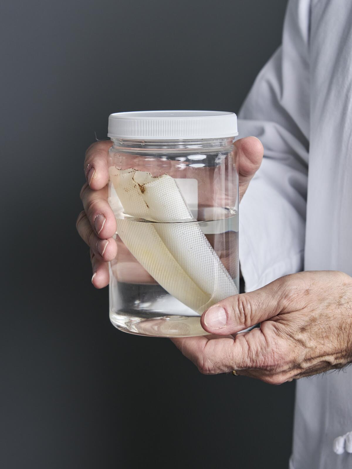 A Penuma implant, which was removed from the patient, appeared in the jar.