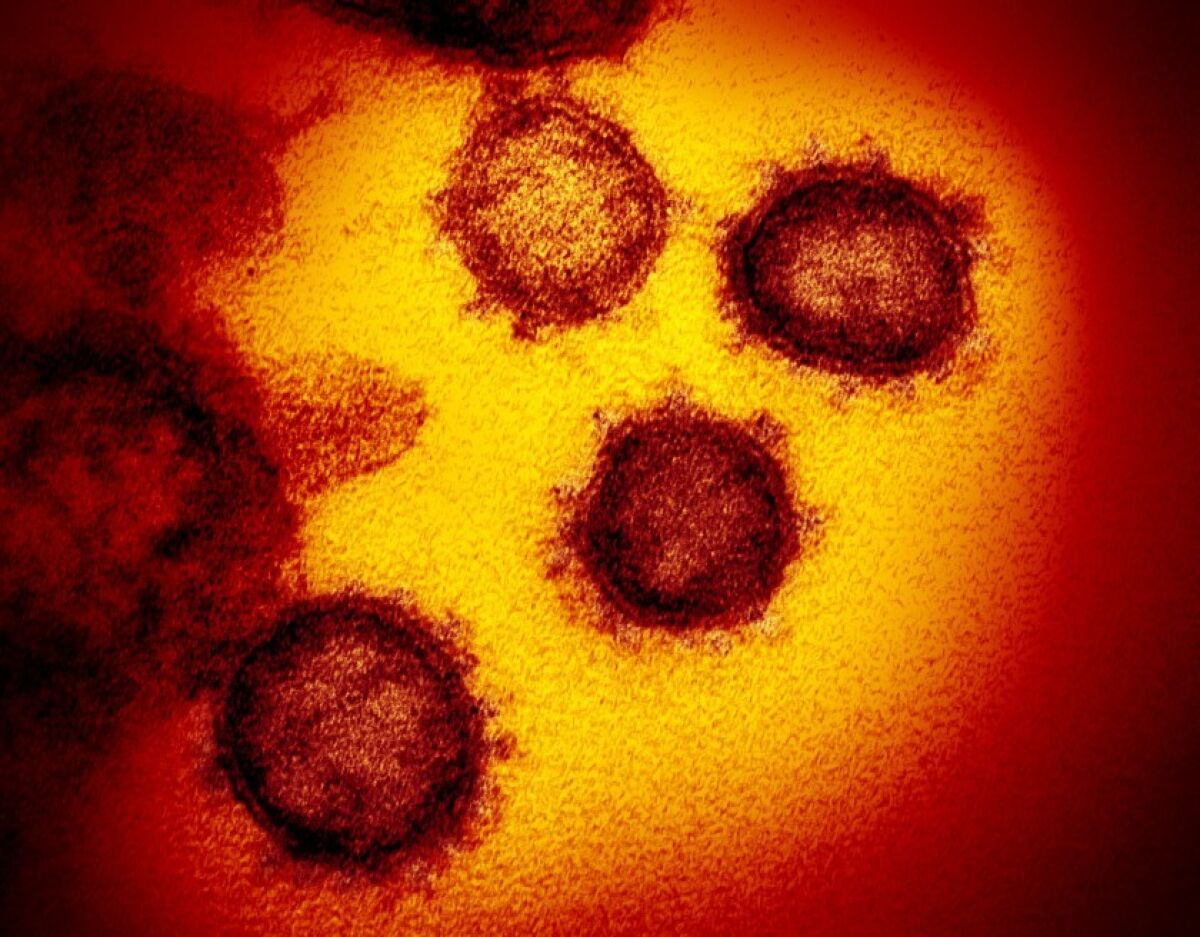 The coronavirus is seen under an electron microscope.