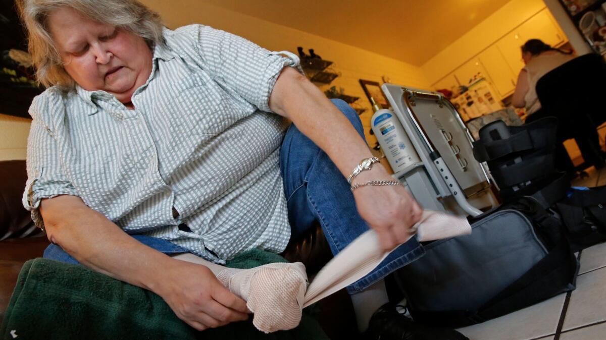 This Arizona woman lost part of her foot to a diabetes-related infection. (Don Bartletti / Los Angeles Times)