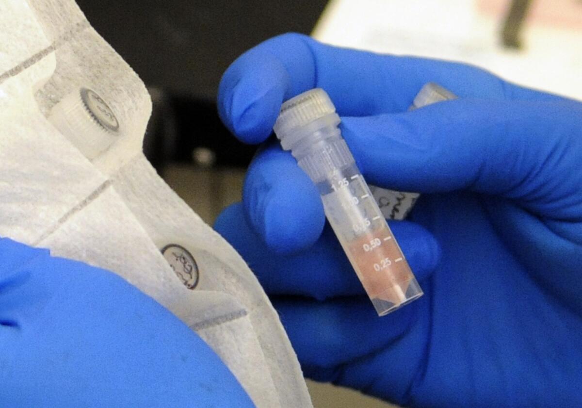 A new study has linked tainted steroid injections to three cases of ischemic stroke. Photo shows a vial of cerebrospinal fluid taken during an outbreak of fungal meningitis last year.