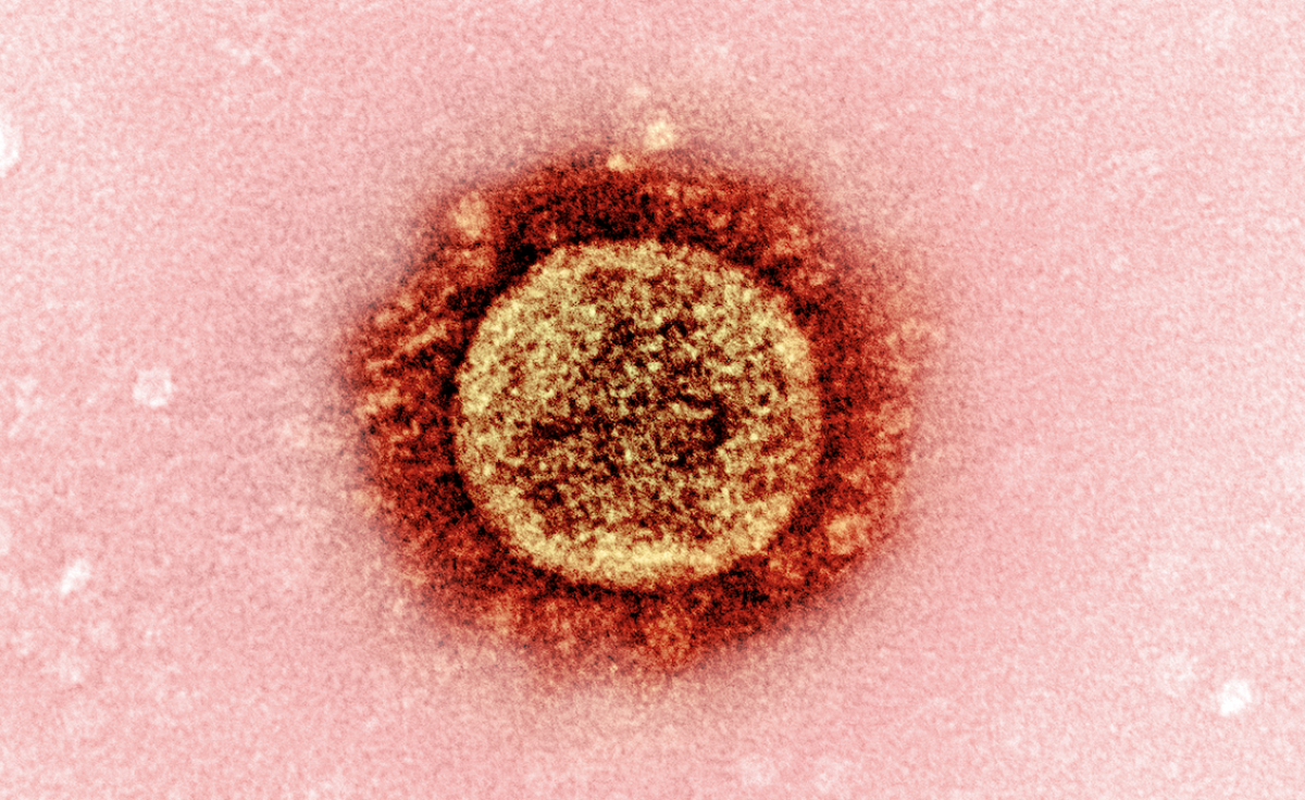 A specimen of the B.1.1.7 coronavirus variant from the United Kingdom is seen under a microscope. 