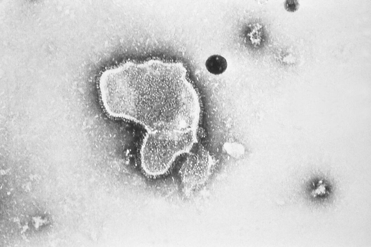 Photo of an electron micrograph of respiratory syncytial virus, also known as RSV. 