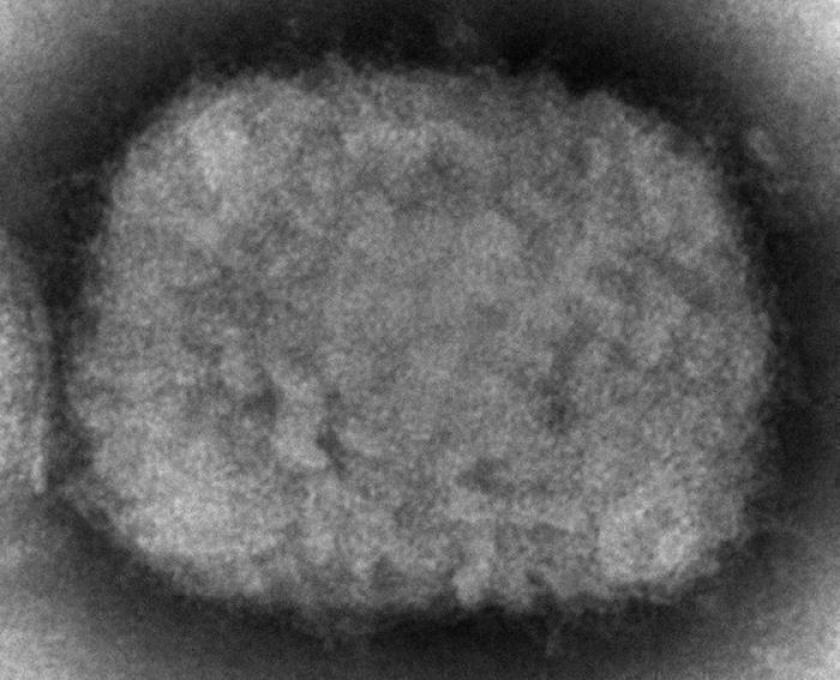 ARCHIVO - Esta imagen de microscopio electrónico de 2003 facilitada por los Centros para el Control y la Prevención de Enfermedades muestra un virión de viruela símica, obtenido de una muestra asociada al brote de perros de la pradera de 2003. Cynthia S. Goldsmith, Russell Regner/CDC vía AP, Archivo)