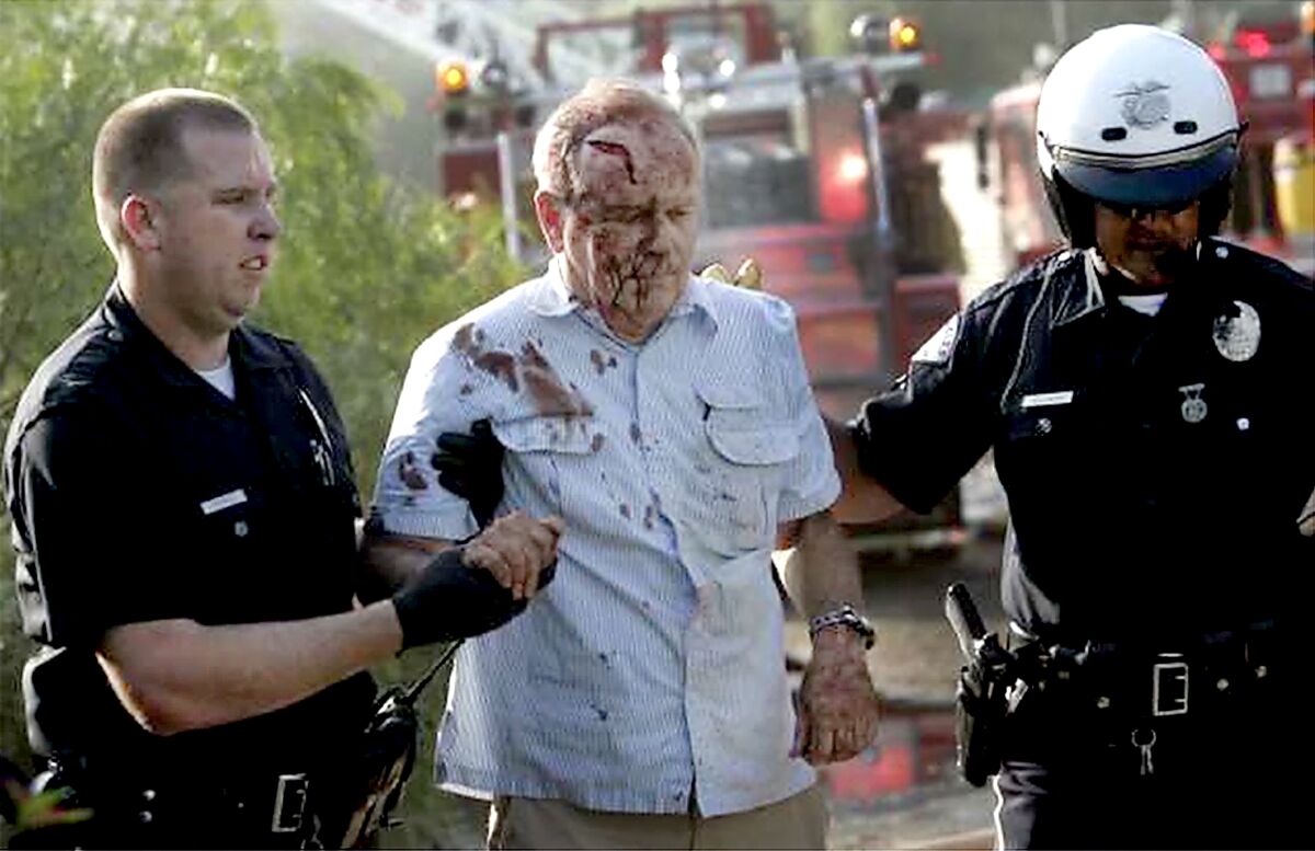 Two police officers on either side of a man with blood on his face and shirt