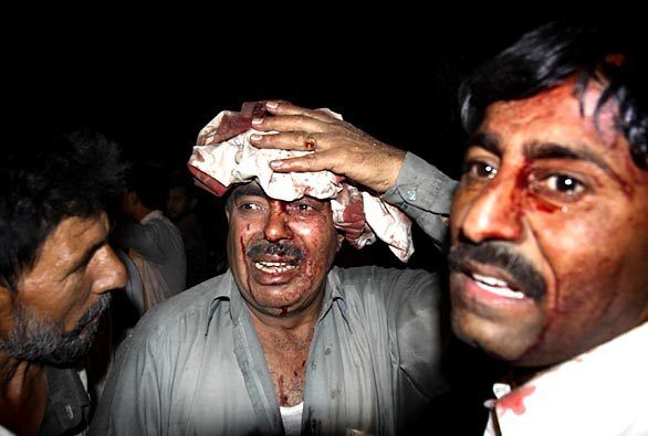 The bomb blast wounded at least 50 people. Pakistani television reported that many of the injured were hotel workers.