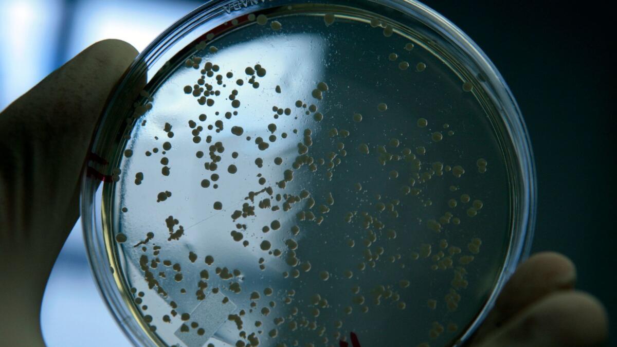 Una muestra de bacterias vivas de MRSA en un laboratorio de la Universidad de Chicago (Zbigniew Bzdak / Chicago Tribune).