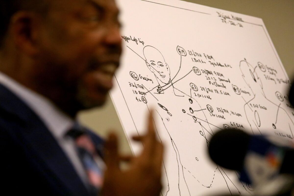 Attorney Carl Douglas, with an image showing bullet wound entries, speaks at a news conference.