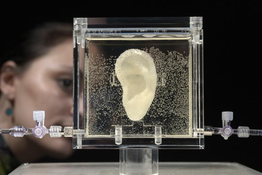 A replica of Dutch painter Vincent van Gogh's famously severed ear on display Wednesday at the Center for Art and Media museum in Karlsruhe, Germany. The ear is said to be made out of tissue grown from the DNA of a relative of the artist.