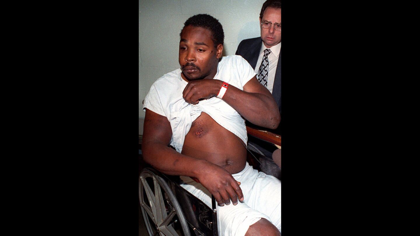 Rodney King shows the bruises he sustained at the hands of four Los Angeles police officers. A citizen with a video camera, George Holliday, had recorded from his balcony the prolonged beating of King by four white police officers.