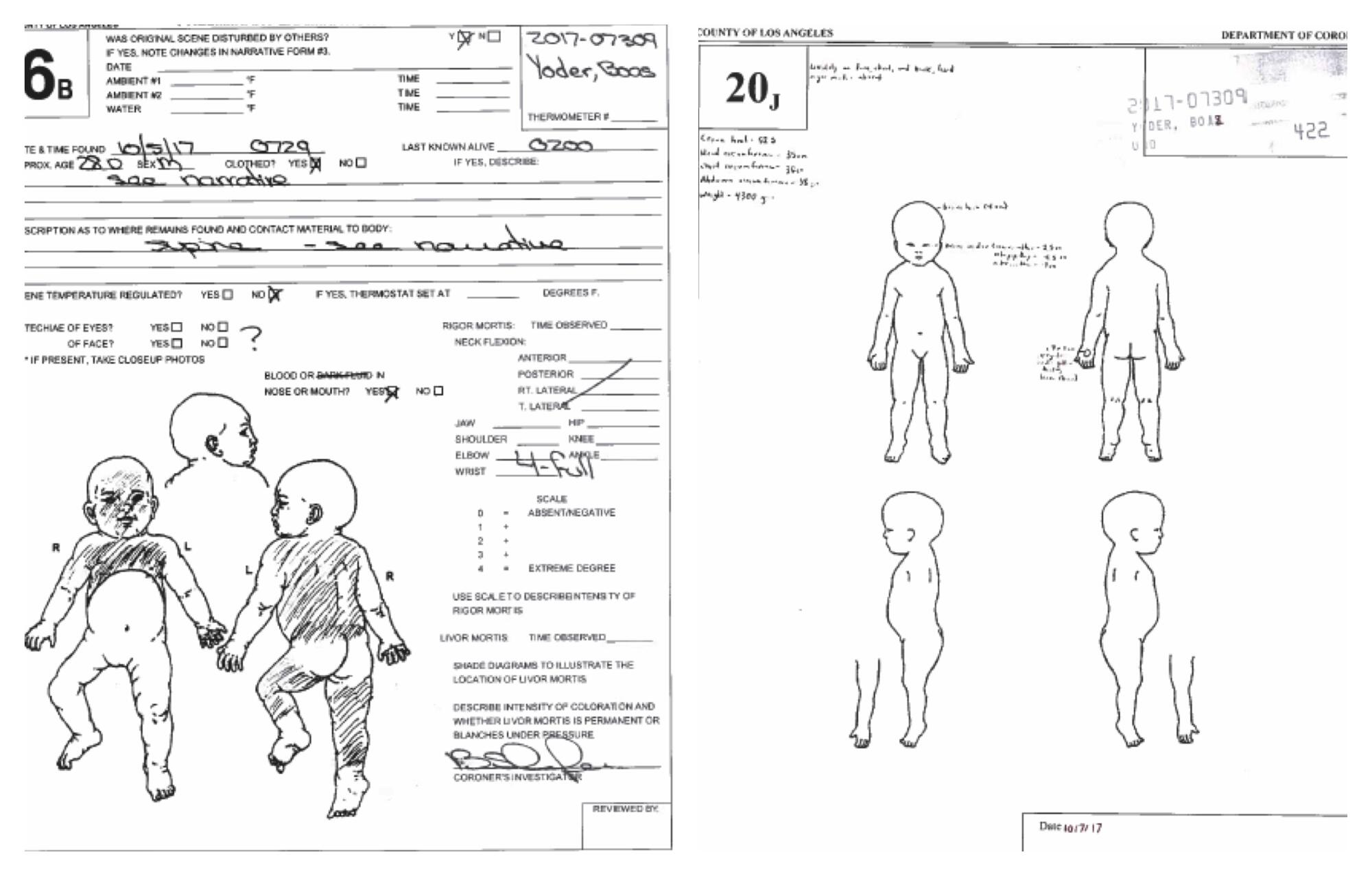 Two documents with drawings of a baby's body.