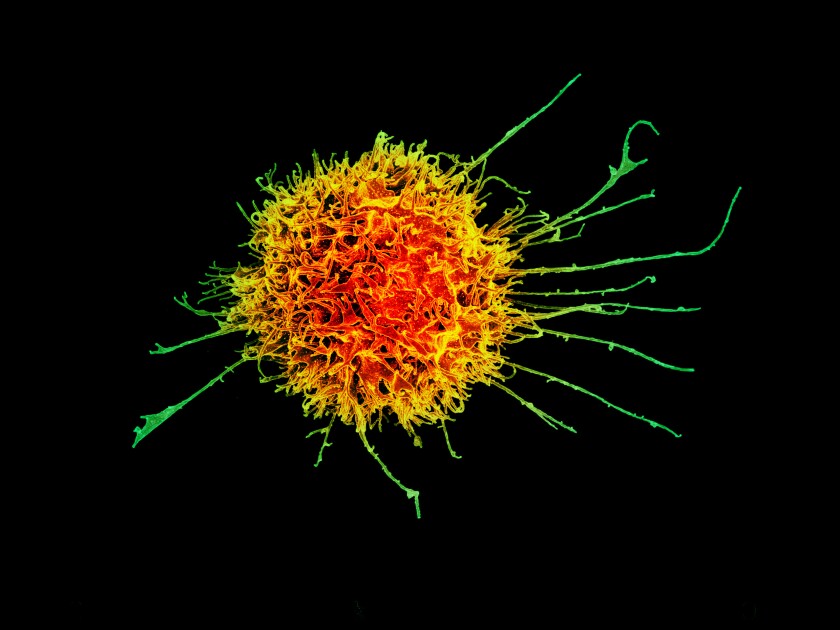 A colored electron micrograph of a natural killer cell.