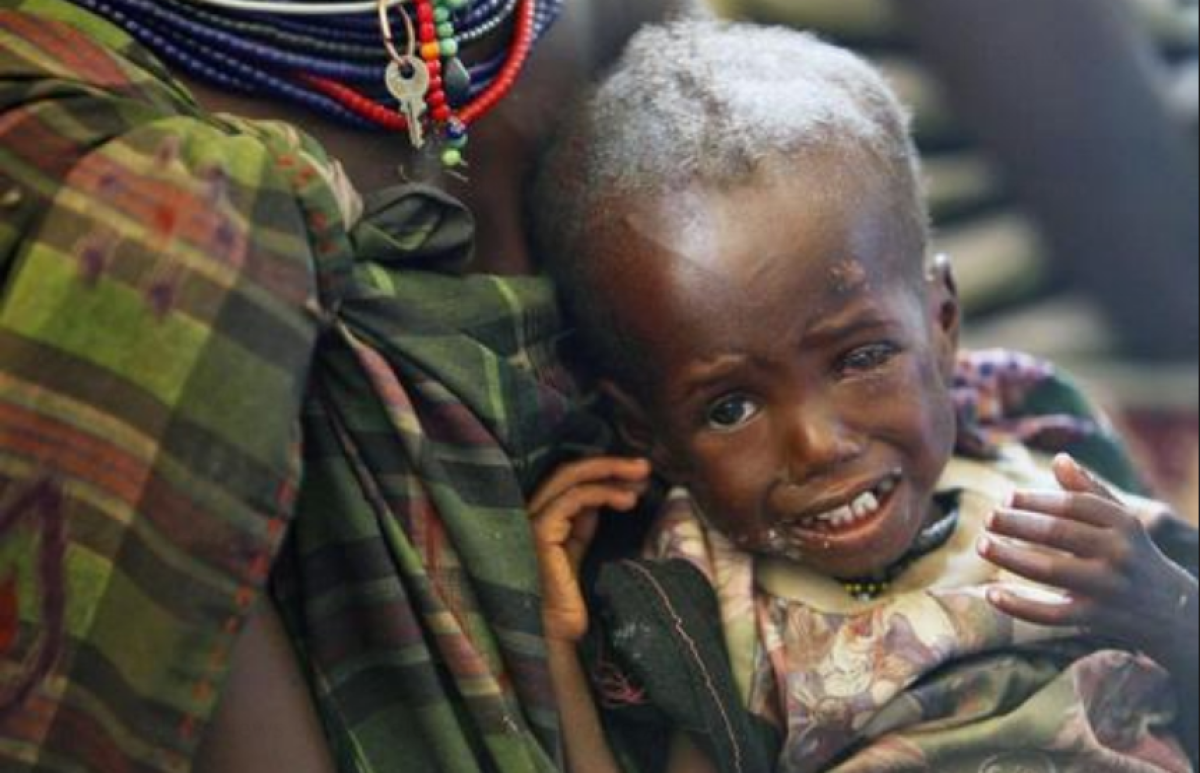 Un niño malnutrido de etnia Turkana esperan su turno para recibir ayuda médica, en el centro de consultas externas de UNIFEC y de la ECHO (departamento de Ayuda Humanitaria de la Comisión europea), en el campo de refugiados de Kakuma, al noroeste de Kenia, el lunes, 8 de agosto de 2011. EFE/Dai Kurokawa/Archivo