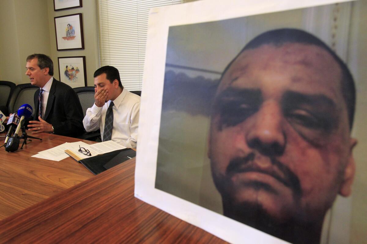 Gabriel Carrillo sits with attorney Ron Kaye, left, and a photo of himself after he was beaten by deputies at a news conference announcing his $1.18-million settlement in a lawsuit against Los Angeles County.