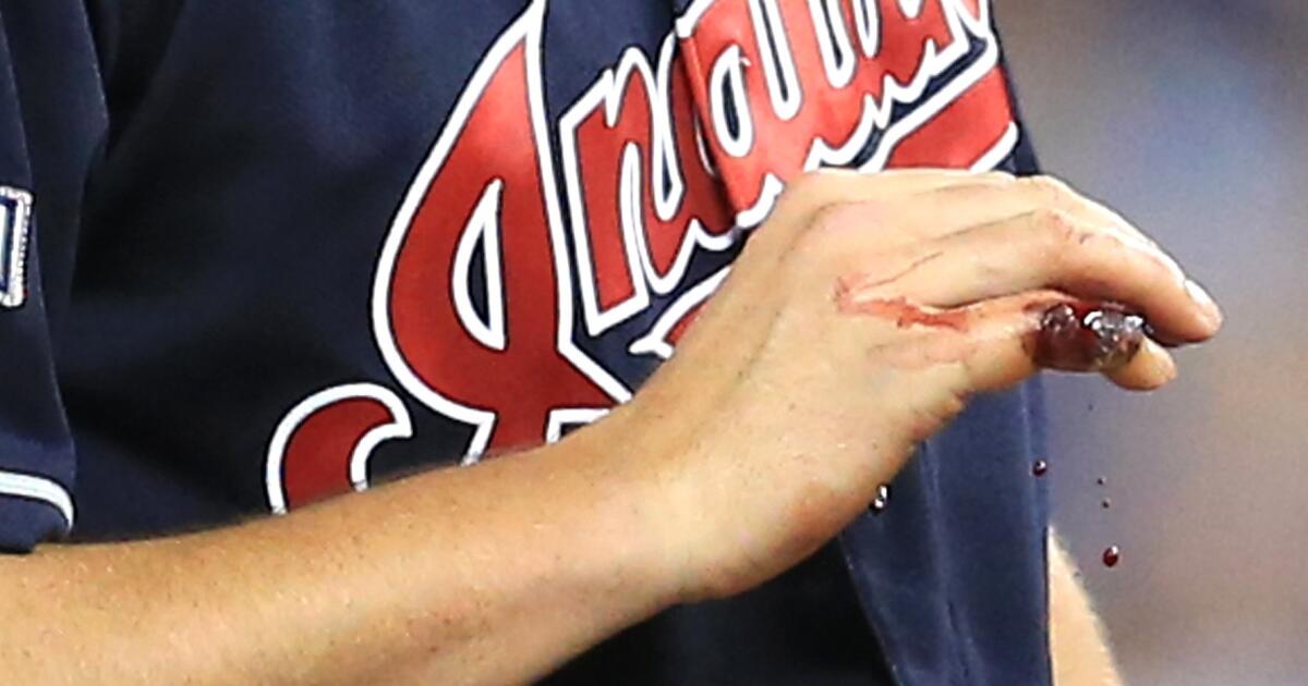 Trevor Bauer Exits in 1st Inning of ALCS Game 3 Because of Bloody Finger  Injury, News, Scores, Highlights, Stats, and Rumors