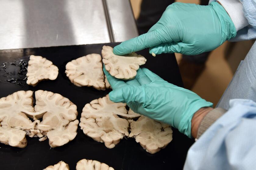 BOSTON, 8/28/2019 - The fixed (preserved -jr) brain of a football player suspected to have suffered from CTE is cut into slices in the VA's brain lab in an early step on the way to determine whether the man suffered from CTE. Josh Reynolds/ For the Times