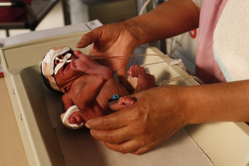 A nurse attends to a newborn baby in the intensive care unit of the Women's Hospital maternity ward in La Paz, Bolivia, Thursday, Aug. 13, 2020. Doctors say the supply of oxygen for the babies is becoming scarce, the result of nationwide blockades by supporters of the party of former President Evo Morales who object to the recent postponement of elections. Bolivia's political and social crisis is coinciding with the continued spread of the new coronavirus across one of Latin America's poorest countries. (AP Photo/Juan Karita)