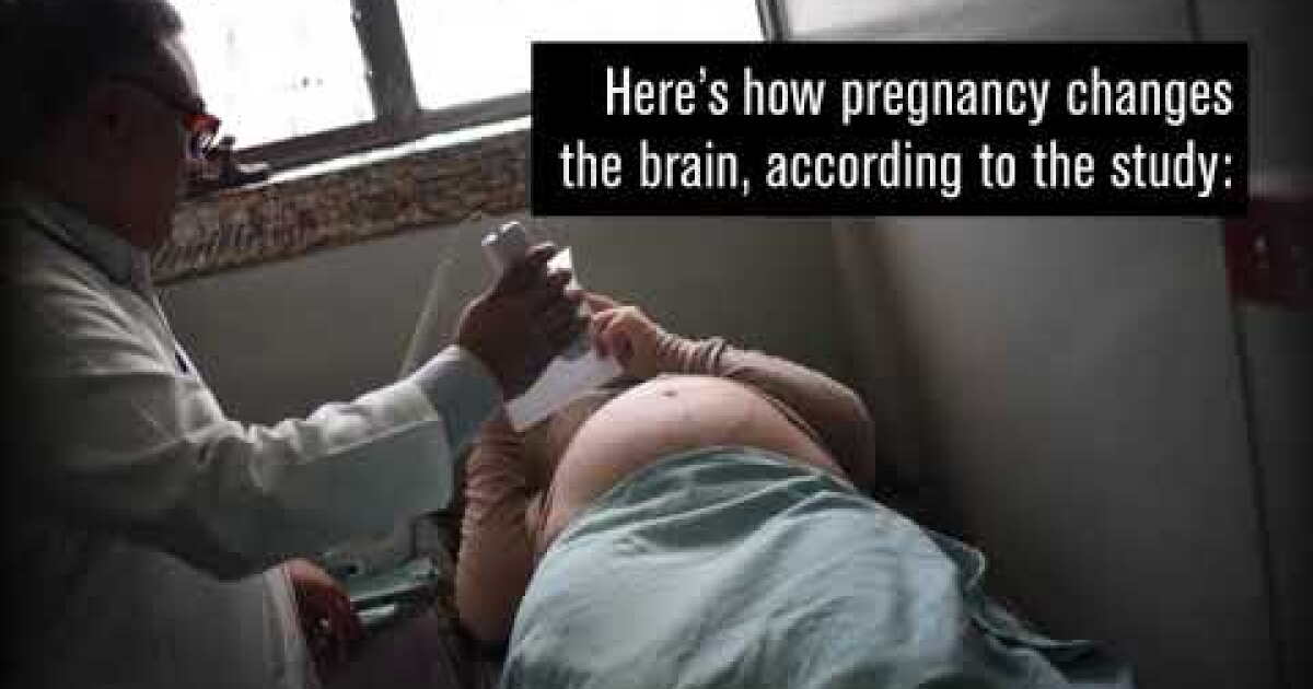 Pregnancy brain is real, lasting — and probably good for baby - Los ...