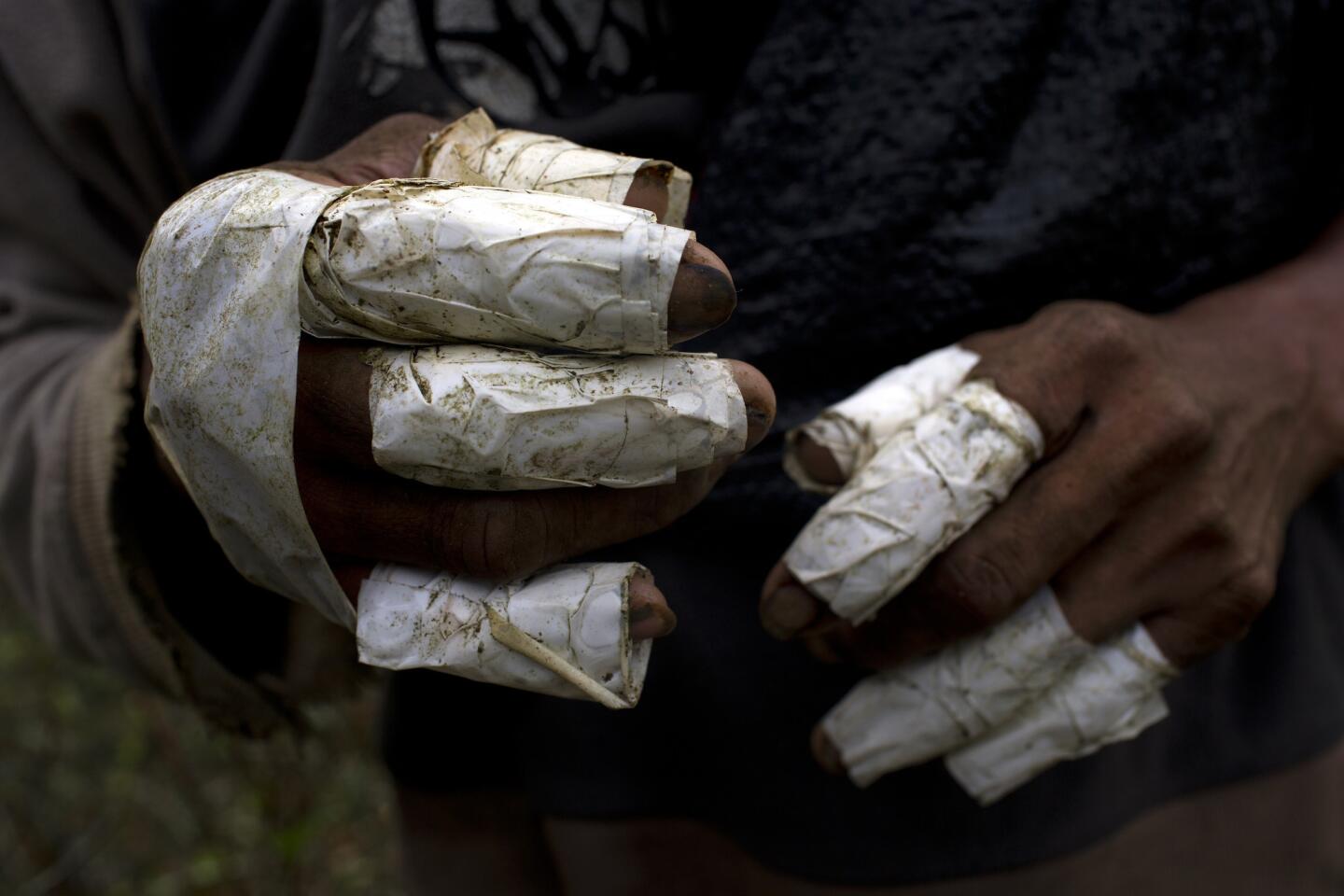 Los dedos del recolector de coca Walter Pérez envueltos en cinta como medida de protección a la hora de retirar la hoja de coca de las ramas. Los recolectores ganan unos 33 centavos por kilo (2,2 libras) de hoja de coca, con lo que de media obtienen unos 16 dólares por día de trabajo.