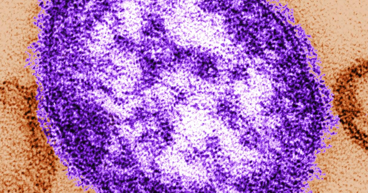 Measles case reported at LAX, Orange County children's hospital. Who is at risk? Measles case reported at LAX, Orange County children's hospital. Who is at risk?