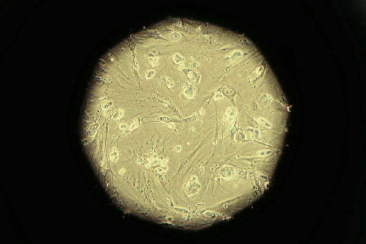 Embryonic stem cells under a microscope.