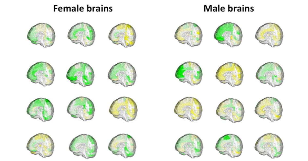 There's no such thing as a 'male brain' or 'female brain,' and scientists have the scans to prove it