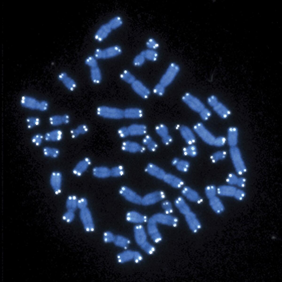 Esta imagen de microscopio muestra los 46 cromosomas humanos. Una nueva investigación ofrece algunas de las primeras pistas biológicas de por qué las mujeres pueden ser más propensas que los hombres a desarrollar la enfermedad de Alzheimer.
