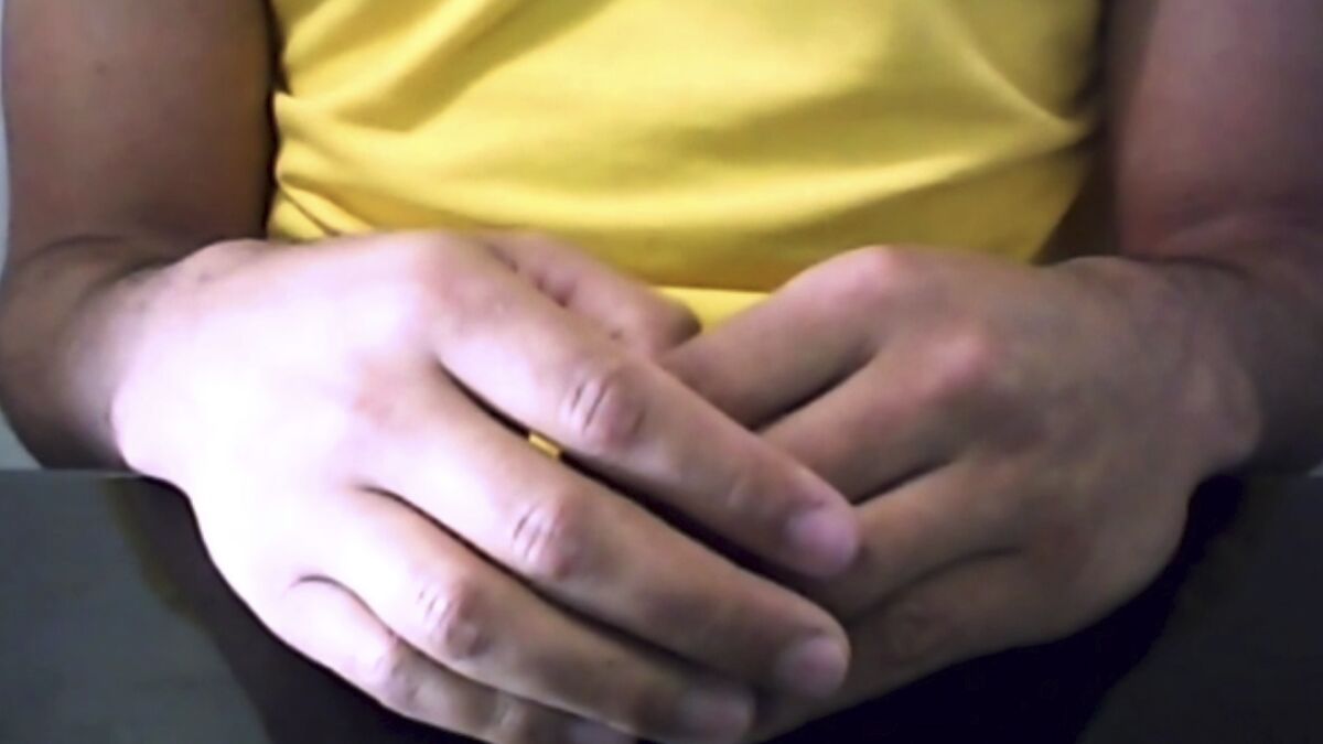 The hands of a Brazilian man who had been infected with HIV