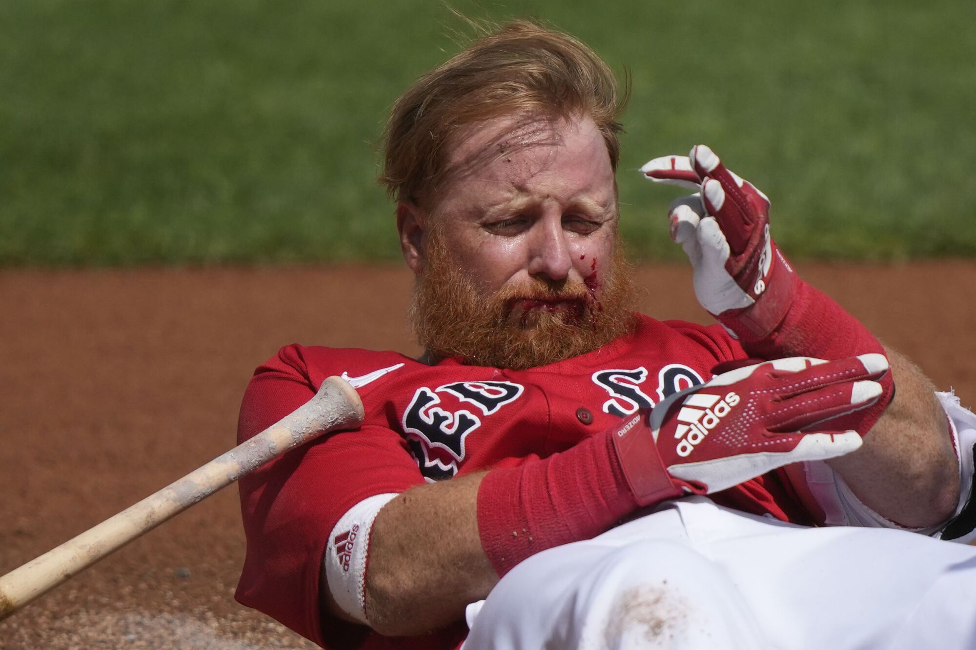 Justin Turner reacts after being hit in the face by a pitch by Tigers pitcher Matt Manning during spring training on March 6.
