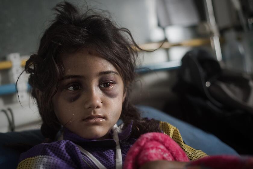 Salina Dhakal, 8, sits on her bed at the National Trauma Center hospital in Katmandu, Nepal, on April 30.