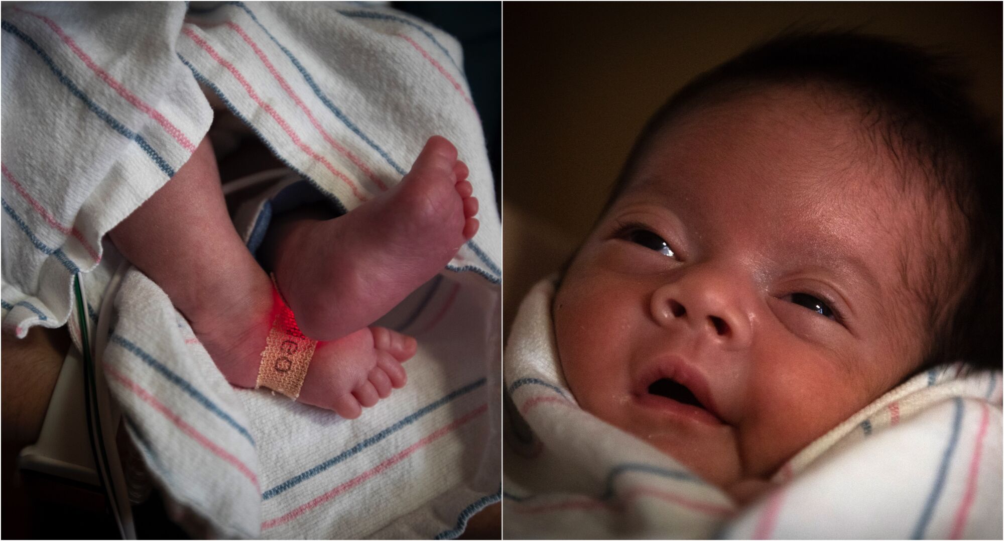 Newborn Emiliana Ramirez in the NICU at Loma Linda University Children's Hospital.
