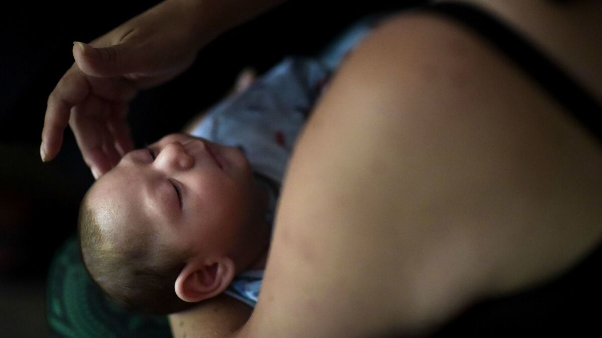 Michelle Flandez of Puerto Rico caresses her 2-month-old son, Inti Perez, who was diagnosed with microcephaly linked to the mosquito-borne Zika virus.