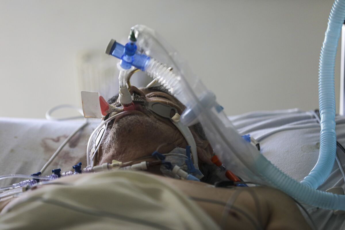 A 68-year-old coronavirus patient breathes through a ventilator at Paradise Valley Hospital in National City on July 8. 