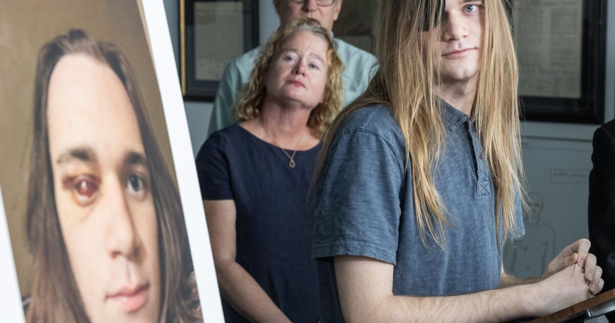 Un travailleur migrant a reçu une balle dans le visage lors de l’événement « No Kings ». Ses avocats envisagent de déposer une plainte auprès de la Sécurité intérieure