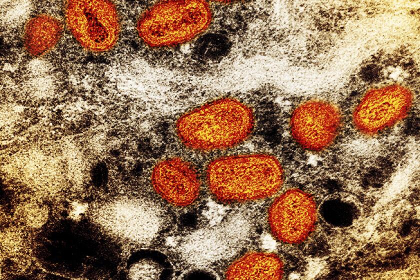 This iamge provided by the National Institute of Allergy and Infectious Diseases (NIAID) shows a colorized transmission electron micrograph of monkeypox particles (orange) found within an infected cell (brown), cultured in the laboratory. This image was captured at the NIAID Integrated Research Facility (IRF) in Fort Detrick, Md. The World Health Organization recently declared the expanding monkeypox outbreak a global emergency. It is WHO’s highest level of alert, but the designation does not necessarily mean a disease is particularly transmissible or lethal. (NIAID via AP)